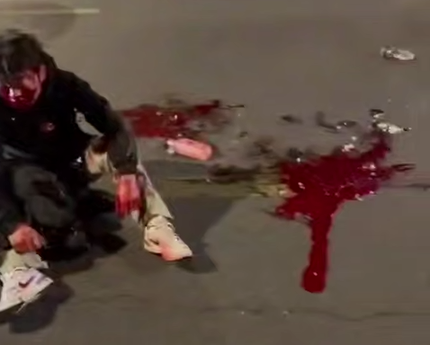 车祸现场，满脸是血
